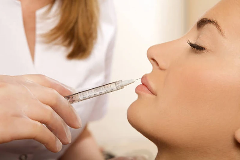 aplicação de botox no bigode chines Pompéia