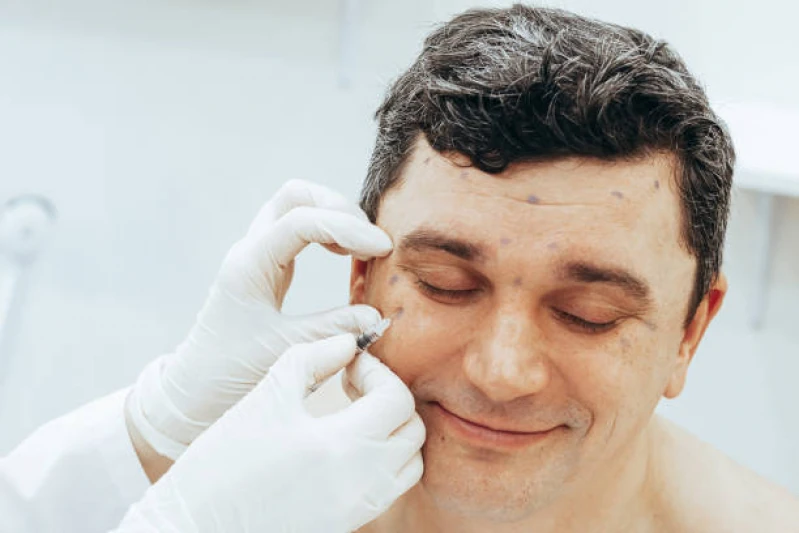 aplicação de toxina botulínica na face Lapa
