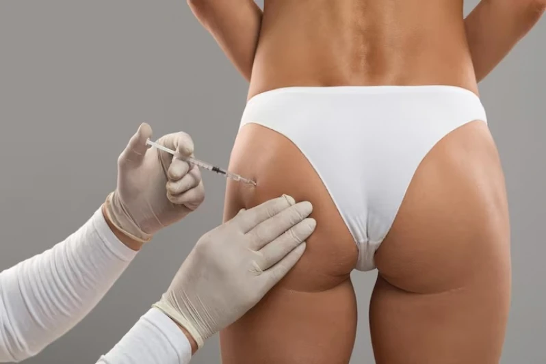 Procedimento de Bioestimulador de Colágeno para Gluteos Vila Madalena