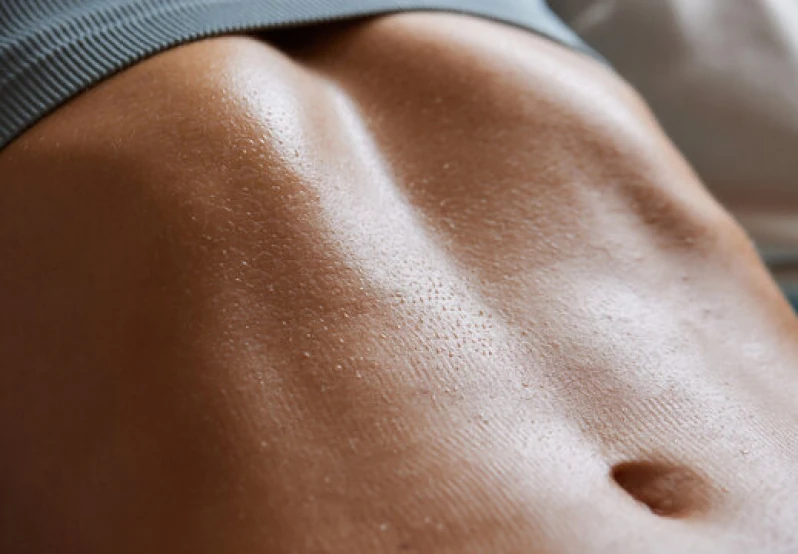 endolift abdomen