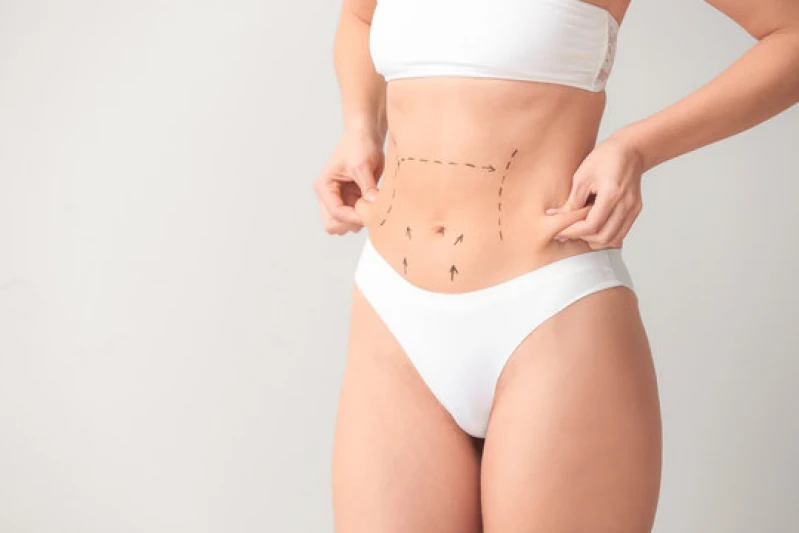 endolifting com laser