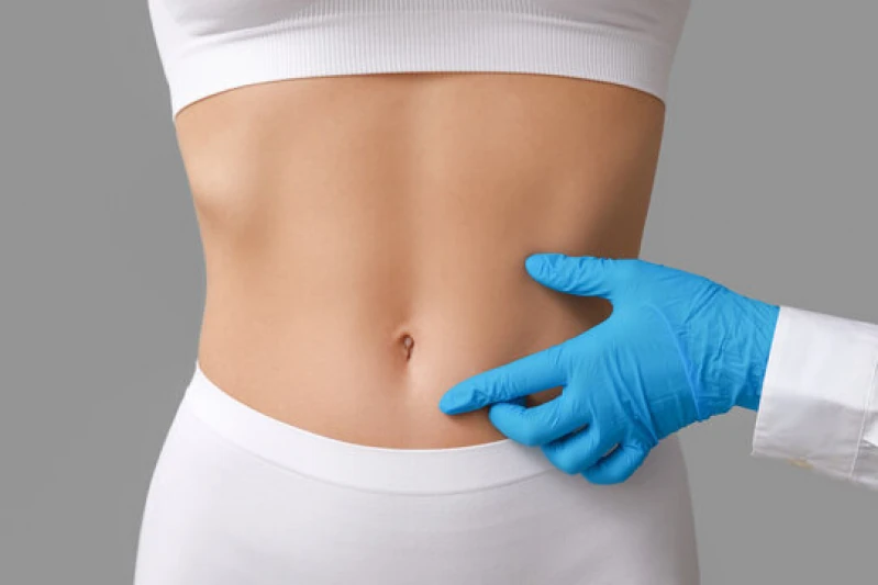endolifting