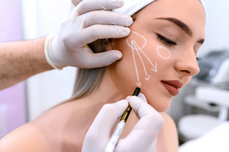 mesoterapia rosto