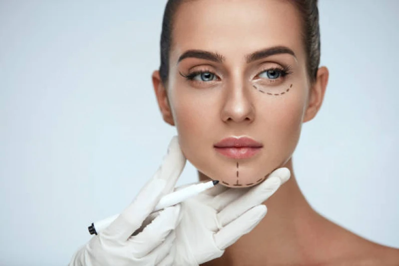 preenchimento facial Vila Madalena
