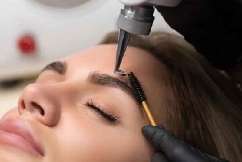 remoção a laser de micropigmentação