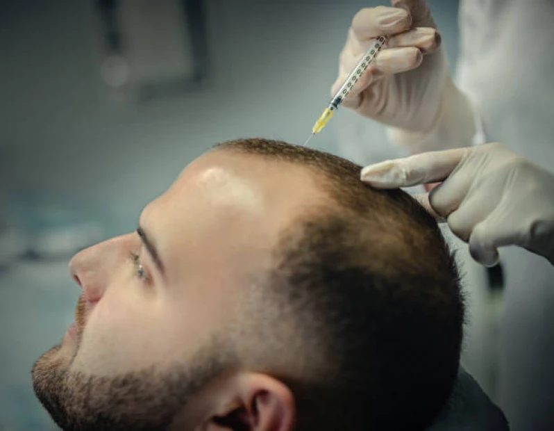 tratamento para queda de cabelo masculino