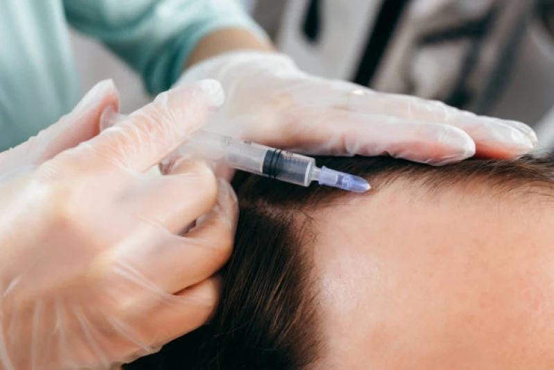 tratamento para queda de cabelo
