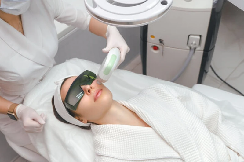 ultraformer área dos olhos