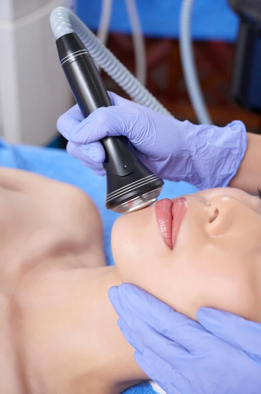 ultraformer para lifting facial